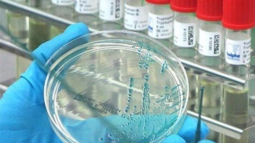 Azerbaijan received monkeypox tests from WHO
