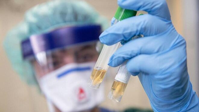 Сегодня проведено 4384 теста на коронавирус